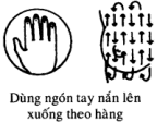 Bệnh Ung Thư Vú - Nguyên nhân, chuẩn đoán và cách điều trị 6